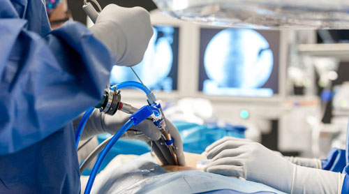 Endoscopic Spine Surgery